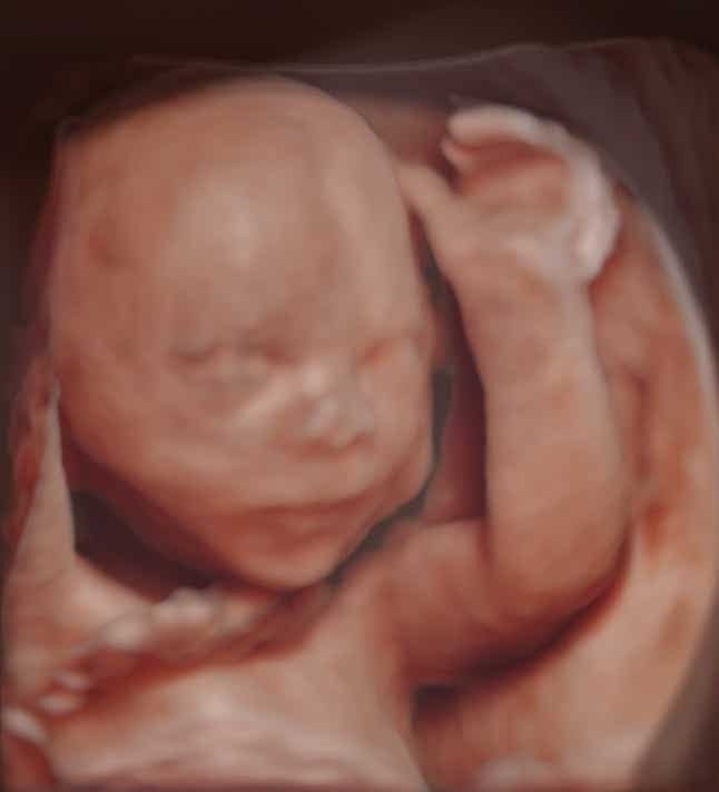 Winkender Fetus 22. SSW